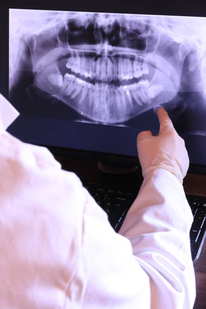 Best Emergency Root Canal Therapy in Plafield, IN