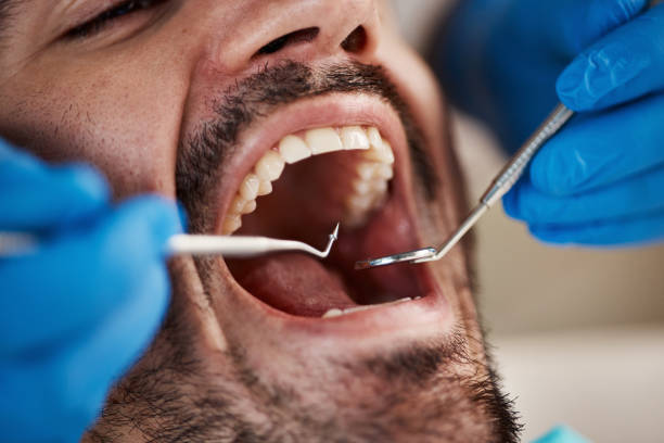 Best Emergency Dental Care for Sports Injuries in Plafield, IN